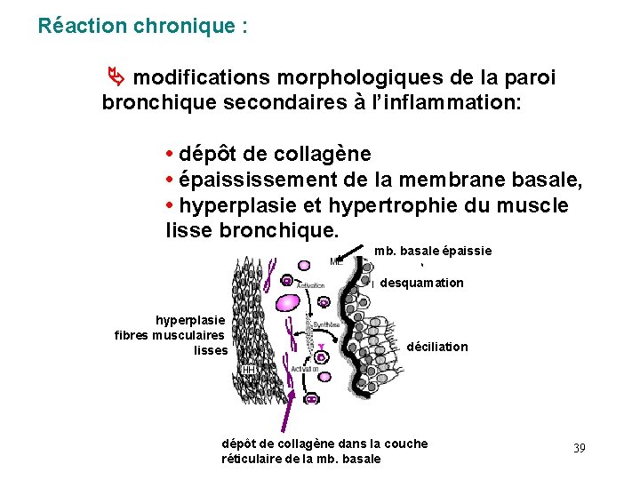 Réaction chronique : modifications morphologiques de la paroi bronchique secondaires à l’inflammation: • dépôt