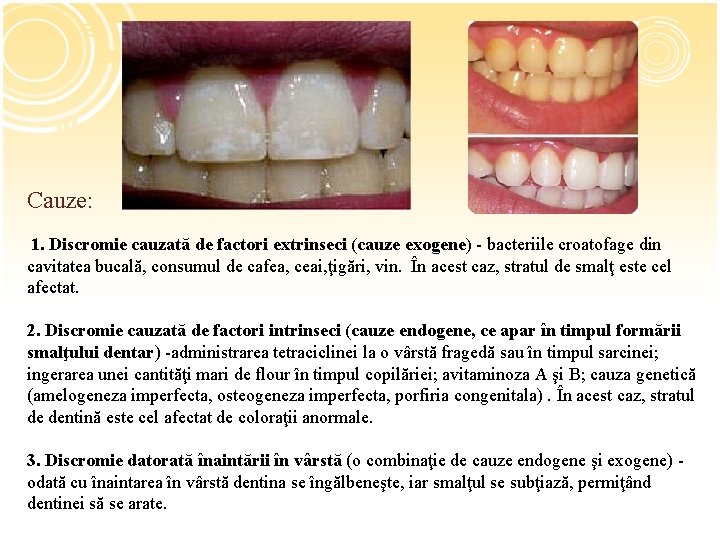 Cauze: 1. Discromie cauzată de factori extrinseci (cauze exogene) - bacteriile croatofage din cavitatea