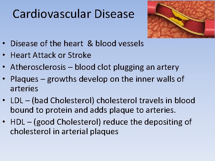 Cardiovascular Disease of the heart & blood vessels Heart Attack or Stroke Atherosclerosis – Cardiovascular Disease of the heart & blood vessels Heart Attack or Stroke Atherosclerosis –