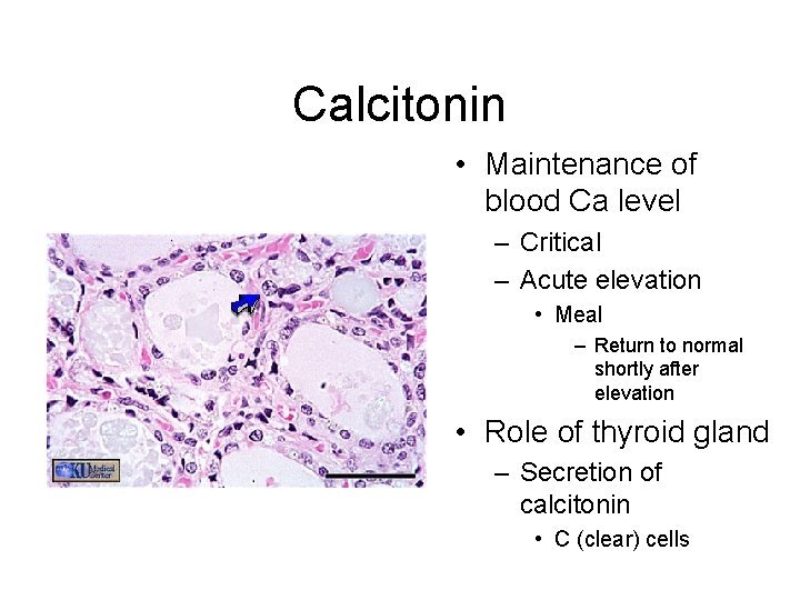 Calcitonin • Maintenance of blood Ca level – Critical – Acute elevation • Meal