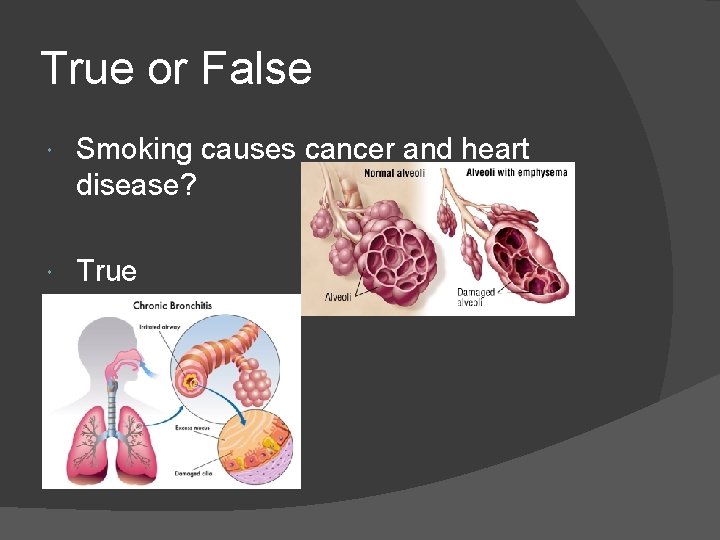 True or False Smoking causes cancer and heart disease? True 