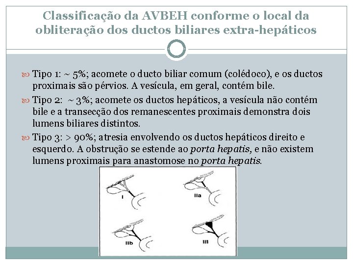 Classificação da AVBEH conforme o local da obliteração dos ductos biliares extra-hepáticos Tipo 1: