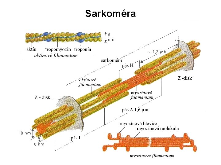 Sarkoméra 