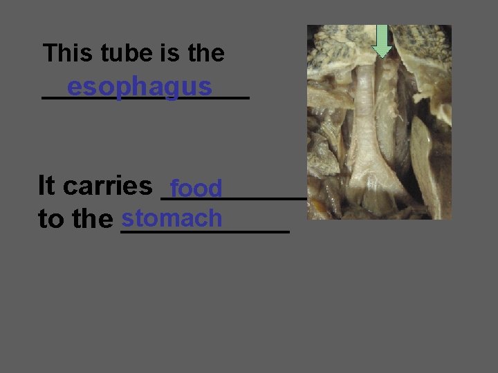 This tube is the ________ esophagus It carries _____ food stomach to the ______