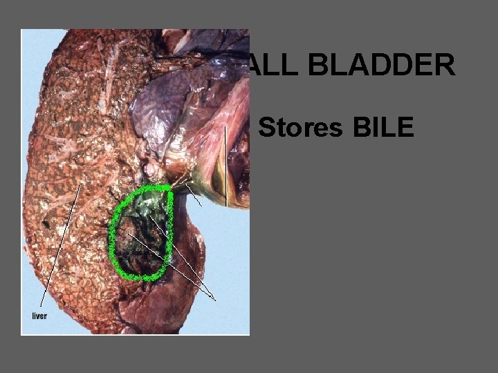 GALL BLADDER Stores BILE 