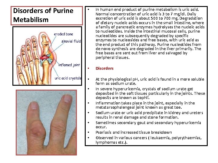 Disorders of Purine Metabilism • In human end product of purine metabolism is uric