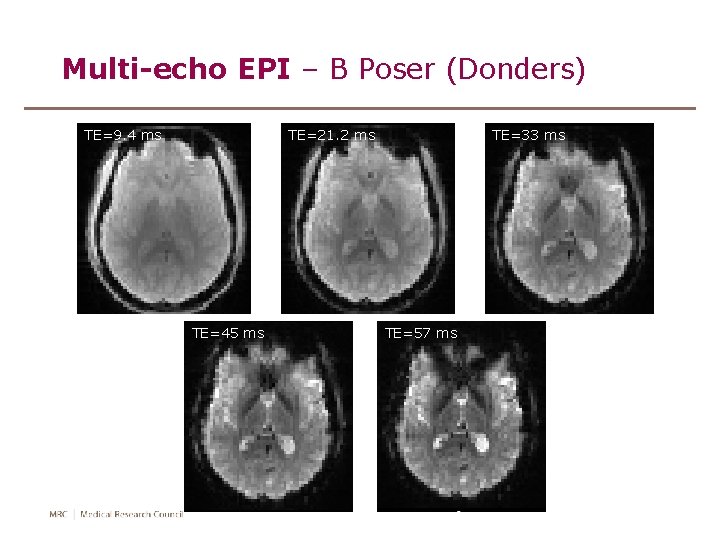 Multi-echo EPI – B Poser (Donders) TE=9. 4 ms TE=21. 2 ms TE=45 ms