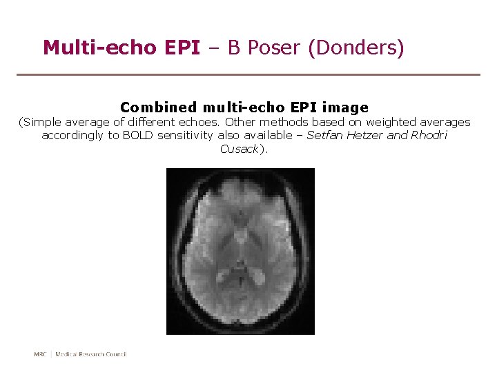 Multi-echo EPI – B Poser (Donders) Combined multi-echo EPI image (Simple average of different