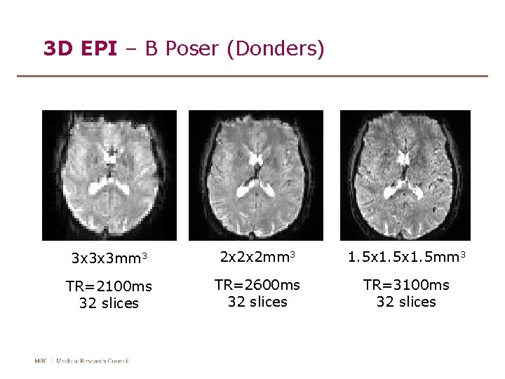 3 D EPI – B Poser (Donders) 3 x 3 x 3 mm 3