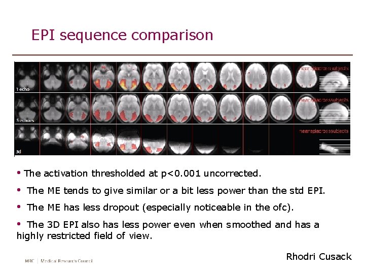 EPI sequence comparison • The activation thresholded at p<0. 001 uncorrected. • The ME