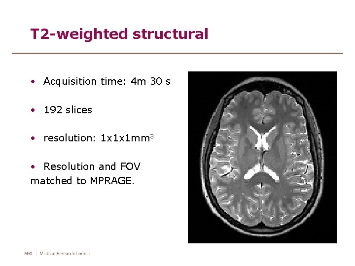 T 2 -weighted structural • Acquisition time: 4 m 30 s • 192 slices