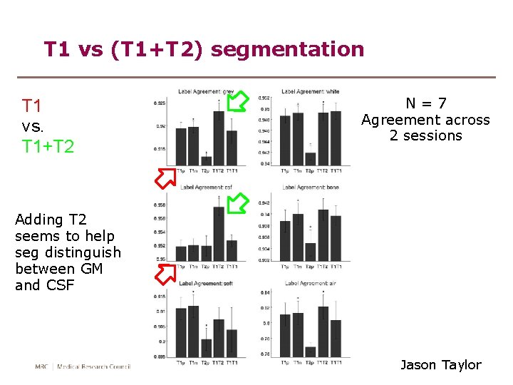 T 1 vs (T 1+T 2) segmentation T 1 vs. T 1+T 2 N=7