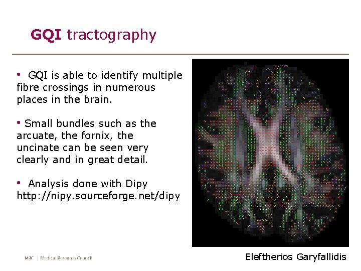 GQI tractography • GQI is able to identify multiple fibre crossings in numerous places