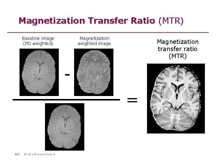 Magnetization Transfer Ratio (MTR) Baseline image (PD weighted) Magnetization weighted image Magnetization transfer ratio