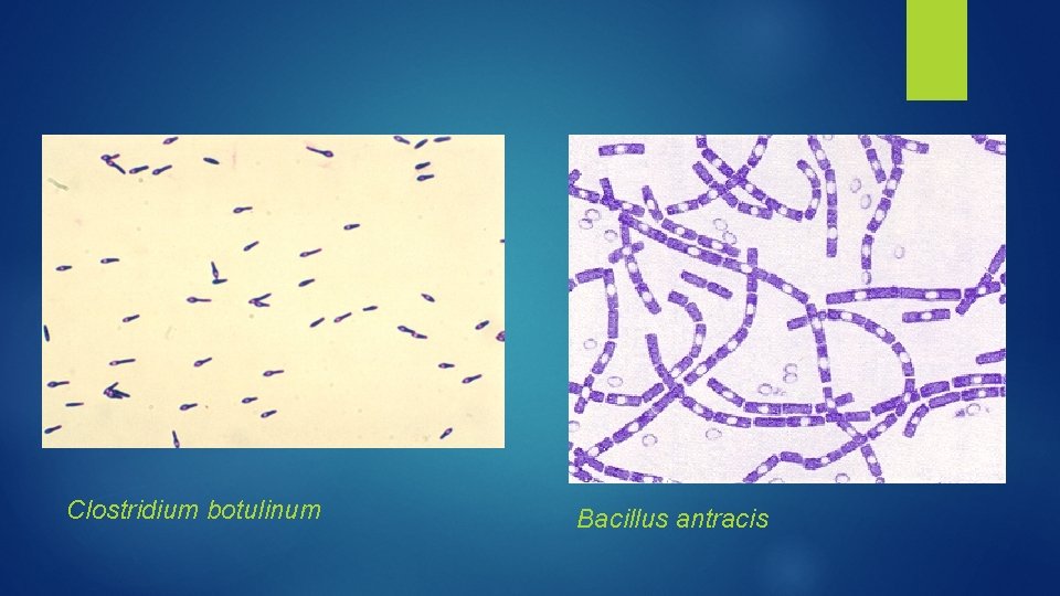 Clostridium botulinum Bacillus antracis 
