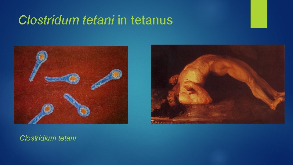 Clostridum tetani in tetanus Clostridium tetani 