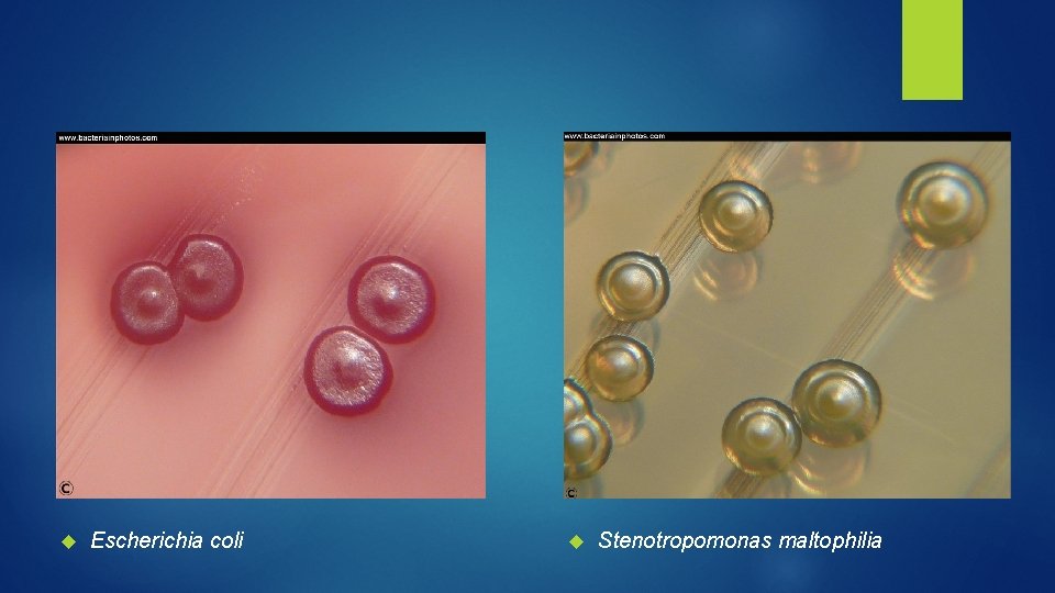  Escherichia coli Stenotropomonas maltophilia 