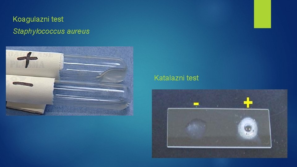 Koagulazni test Staphylococcus aureus Katalazni test 