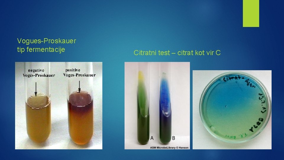 Vogues-Proskauer tip fermentacije Citratni test – citrat kot vir C 