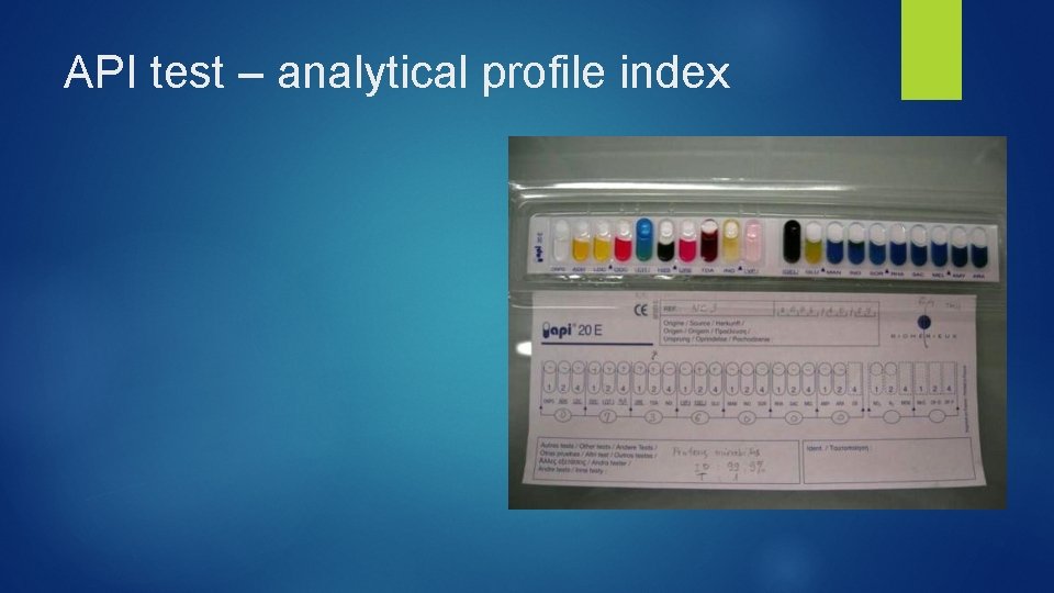 API test – analytical profile index 