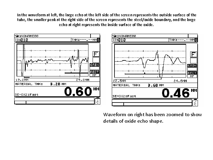 In the waveform at left, the large echo at the left side of the
