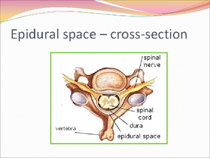 Epidural space – cross-section 