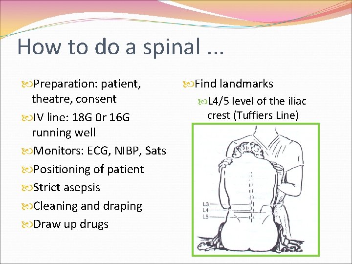 How to do a spinal. . . Preparation: patient, theatre, consent IV line: 18