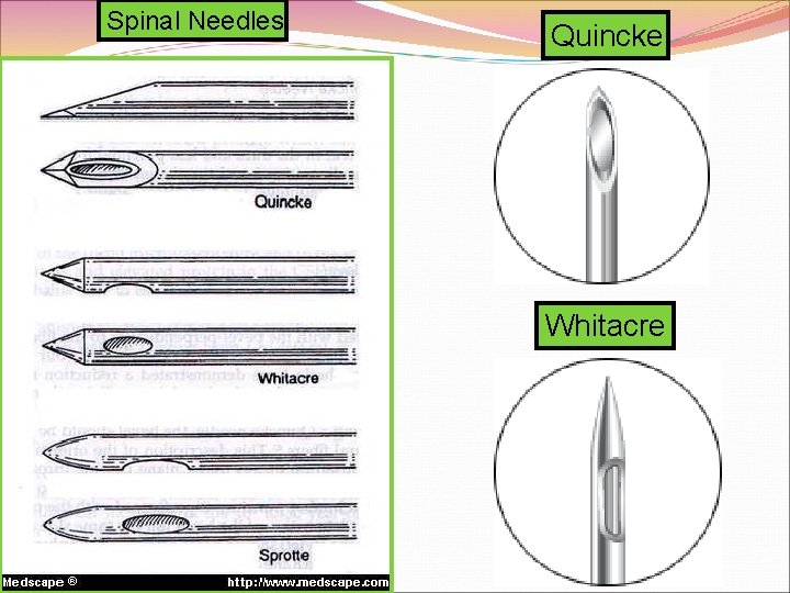 Spinal Needles Quincke Whitacre 