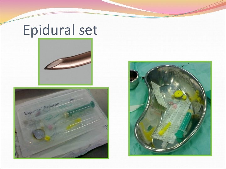 Epidural set 