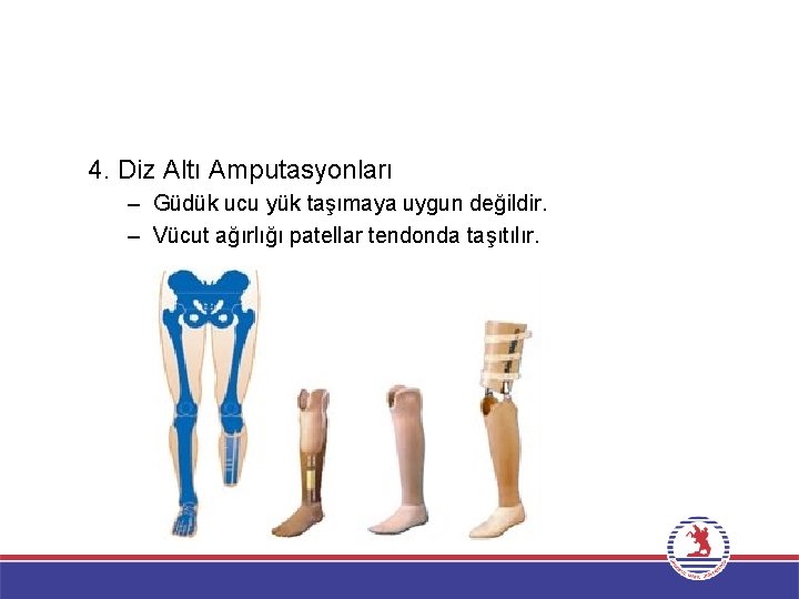 4. Diz Altı Amputasyonları – Güdük ucu yük taşımaya uygun değildir. – Vücut ağırlığı
