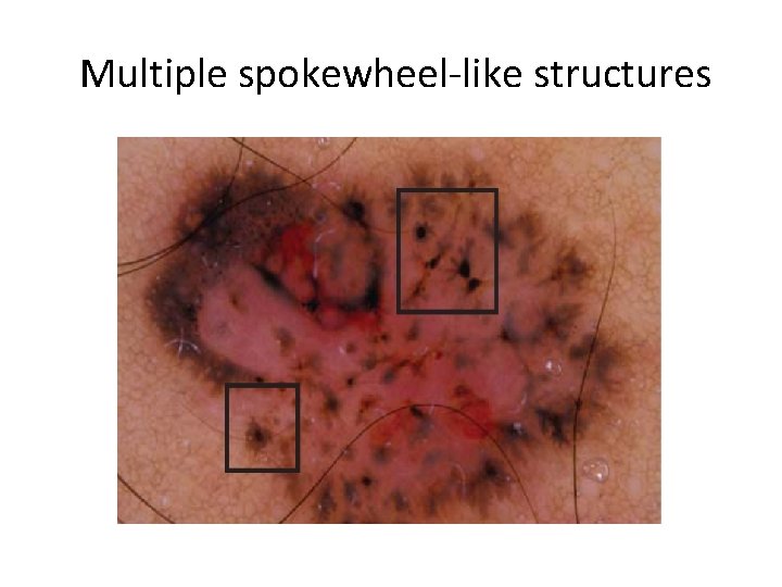 Multiple spokewheel-like structures 