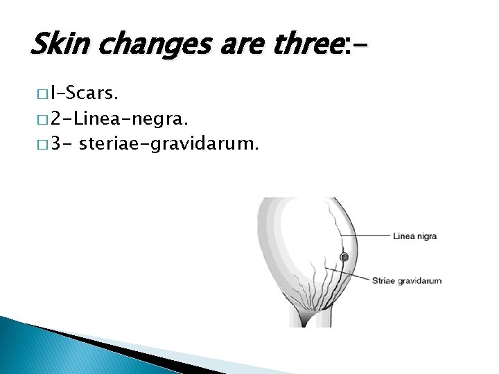 Skin changes are three: � I-Scars. � 2 -Linea-negra. � 3 - steriae-gravidarum. 