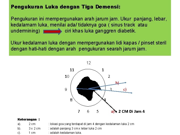 Pengukuran Luka dengan Tiga Demensi: Pengukuran ini mempergunakan arah jarum jam. Ukur panjang, lebar,