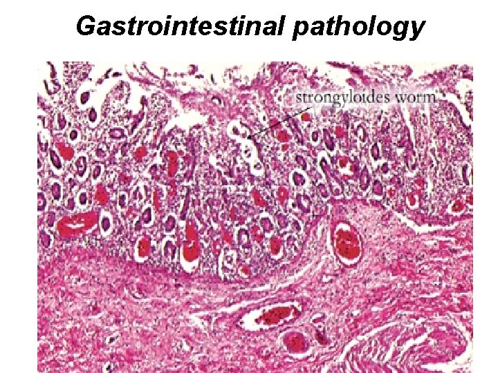 Gastrointestinal pathology 