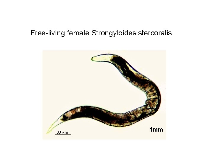 Free-living female Strongyloides stercoralis 30 µm 1 mm 