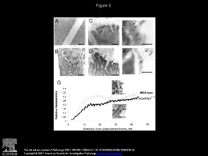 Figure 5 The American Journal of Pathology 2001 1591581 -1592 DOI: (10. 1016/S 0002