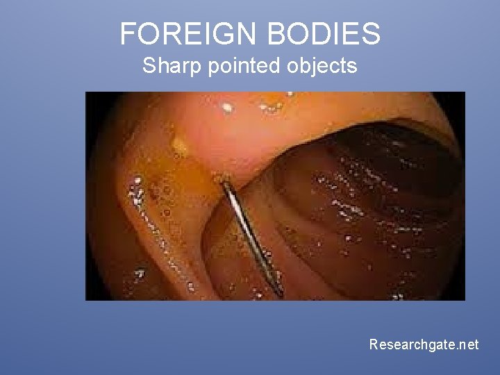 FOREIGN BODIES Sharp pointed objects Researchgate. net 