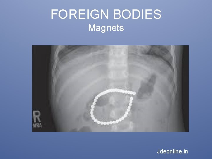 FOREIGN BODIES Magnets Jdeonline. in 