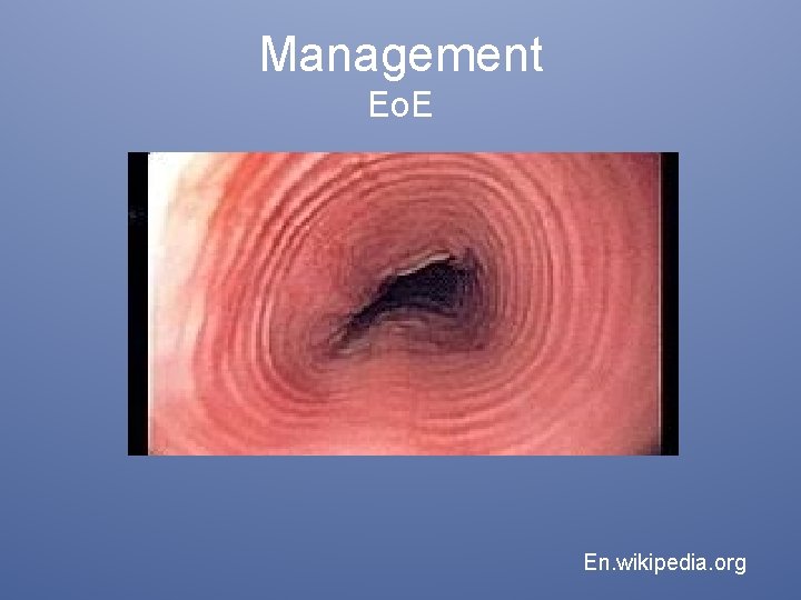 Management Eo. E En. wikipedia. org 