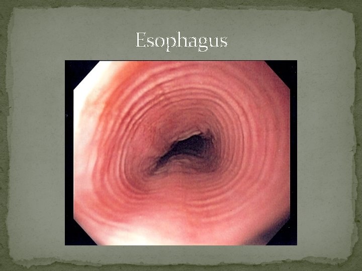 Esophagus 