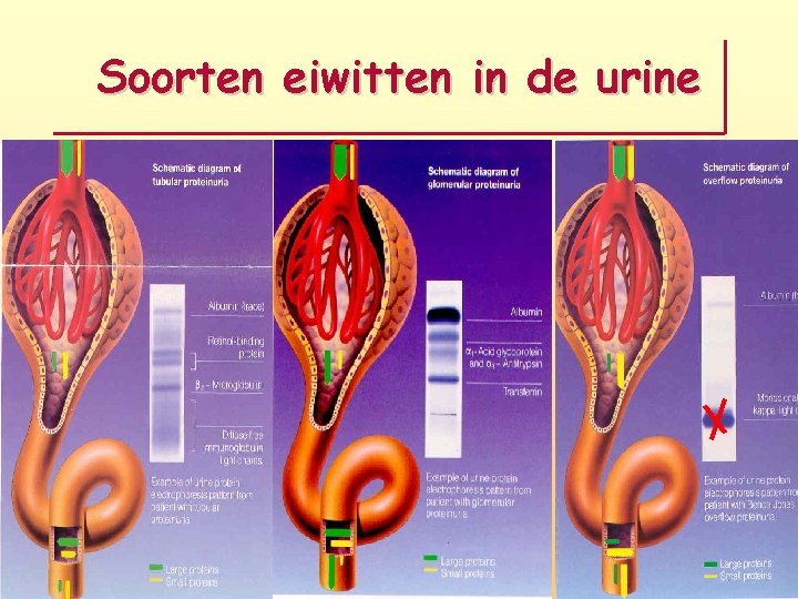 Soorten eiwitten in de urine 