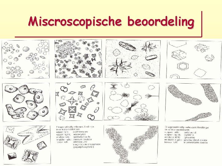 Miscroscopische beoordeling 