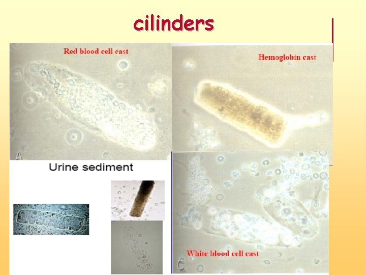 cilinders 