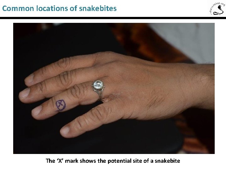 Common locations of snakebites Saw-Scaled Viper The ‘X’ mark shows the potential site of