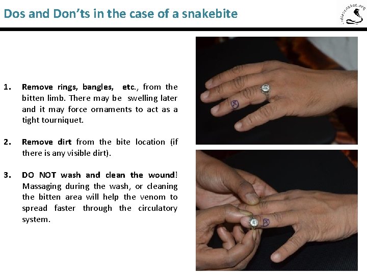 Dos and Don’ts in the case of a snakebite Saw-Scaled Viper 1. Remove rings,