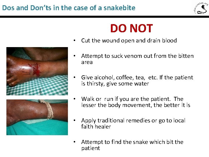 Dos and Don’ts in the case of a snakebite Saw-Scaled Viper DO NOT •