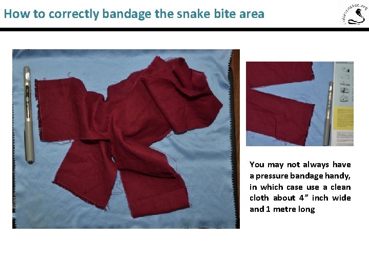 How to correctly bandage the snake bite area You may not always have a