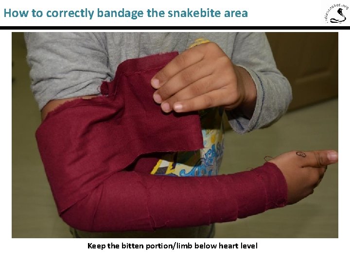 How to correctly bandage the snakebite area Saw-Scaled Viper Keep the bitten portion/limb below