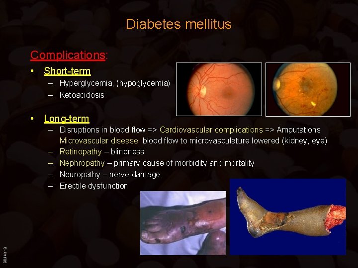 Diabetes mellitus Complications: • Short-term – Hyperglycemia, (hypoglycemia) – Ketoacidosis • Long-term BIMM 118