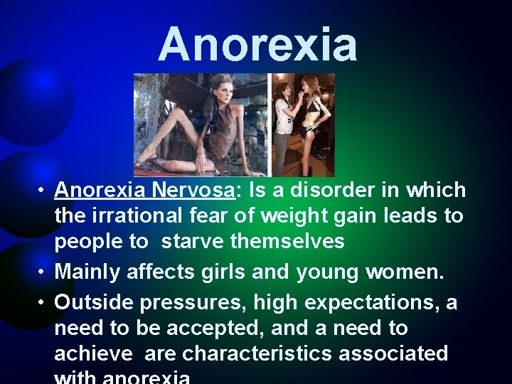 Anorexia • Anorexia Nervosa: Is a disorder in which the irrational fear of weight